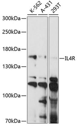 Western blot - IL4R antibody (A14648)