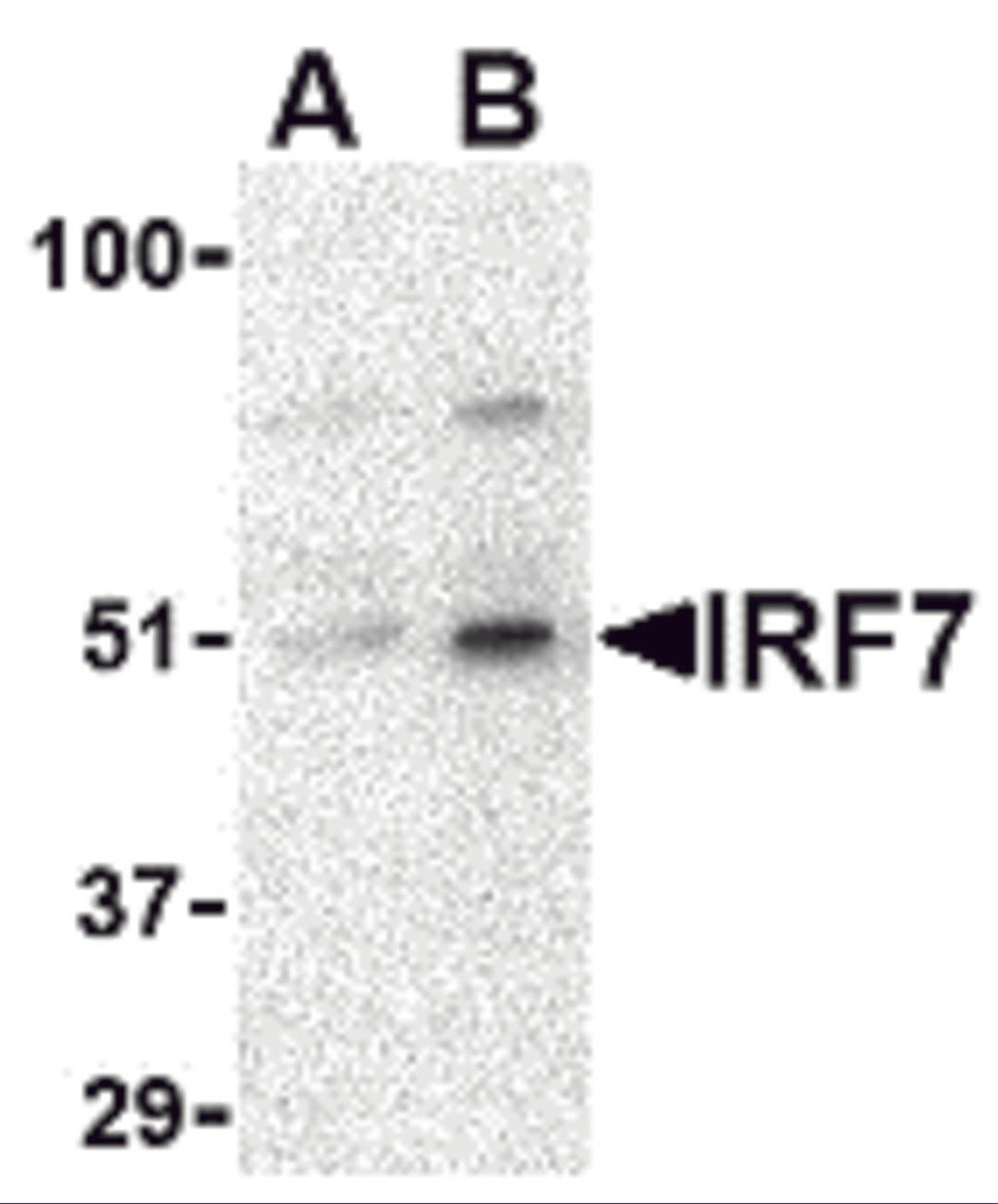 Western blot analysis of IRF7 in 293 whole cell lysate with IRF7 antibody at (A) 0.5 and (B) 1 &#956;g/mL. 