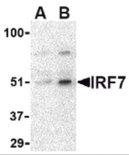 Western blot analysis of IRF7 in 293 whole cell lysate with IRF7 antibody at (A) 0.5 and (B) 1 &#956;g/mL. 