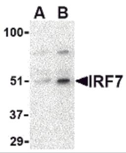 Western blot analysis of IRF7 in 293 whole cell lysate with IRF7 antibody at (A) 0.5 and (B) 1 μg/mL.