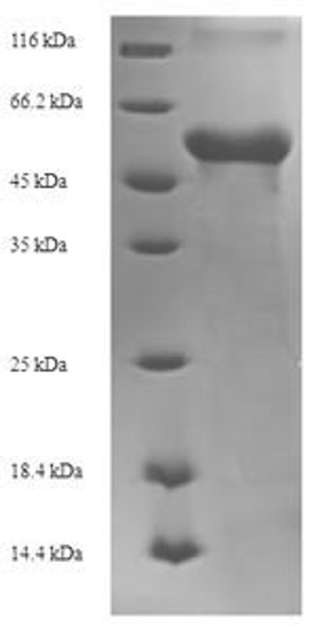 (Tris-Glycine gel) Discontinuous SDS-PAGE (reduced) with 5% enrichment gel and 15% separation gel.