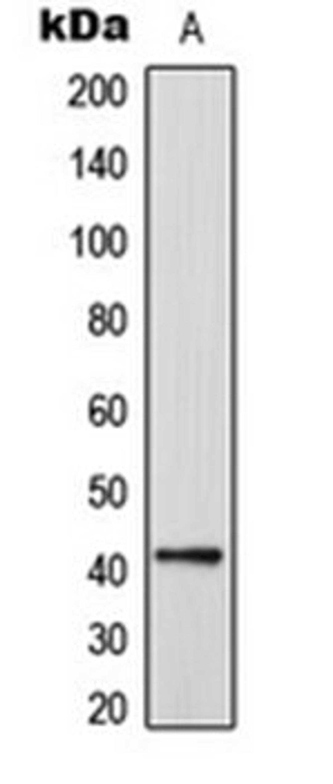 Western blot analysis of HeLa (Lane 1) whole cell lysates using CEP41 antibody