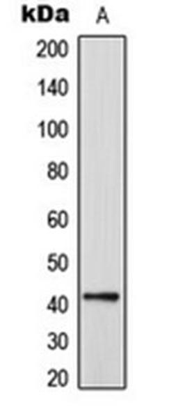 Western blot analysis of HeLa (Lane 1) whole cell lysates using CEP41 antibody