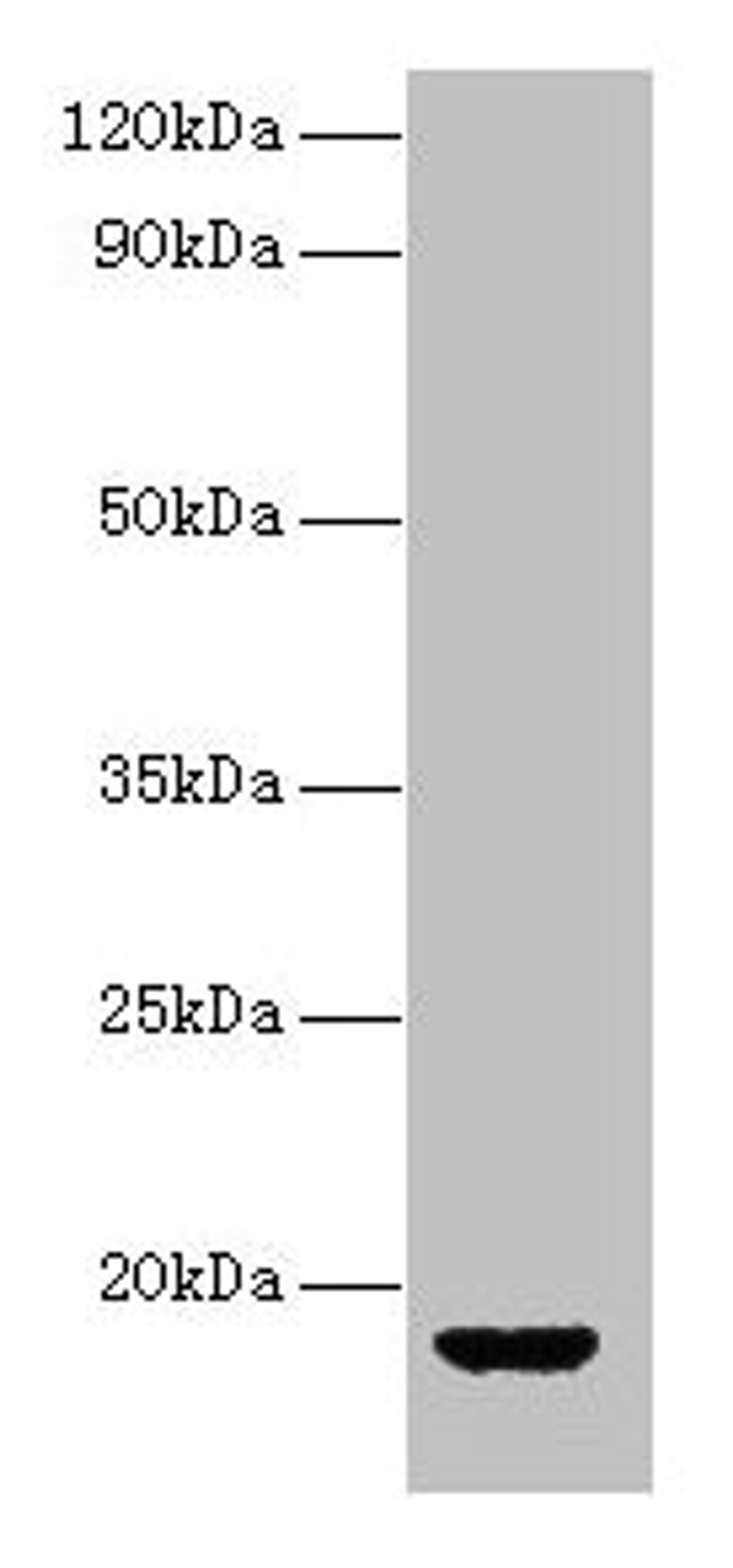 Western blot. All lanes: AVP antibody at 2µg/ml + Rat gonadal tissue. Secondary. Goat polyclonal to rabbit IgG at 1/10000 dilution. Predicted band size: 18 kDa. Observed band size: 18 kDa