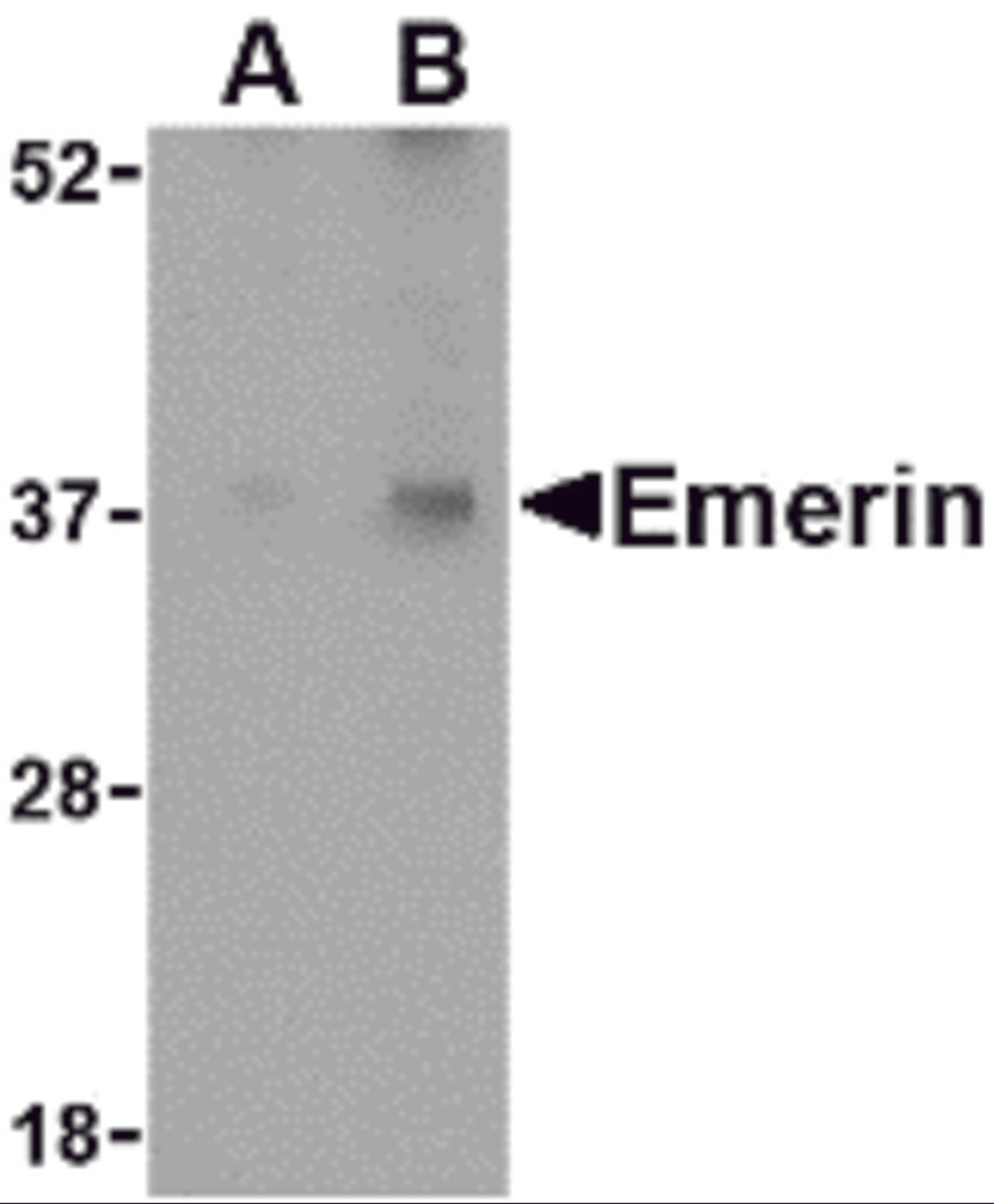 Western blot analysis of Emerin in human skeletal muscle tissue lysate with Emerin antibody at (A) 0.5 and (B) 1 &#956;g/mL.