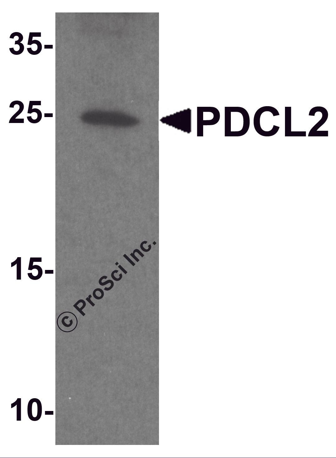Western blot analysis of PDCL2 in rat liver tissue lysate with PDCL2 antibody at 1 μg/ml.
