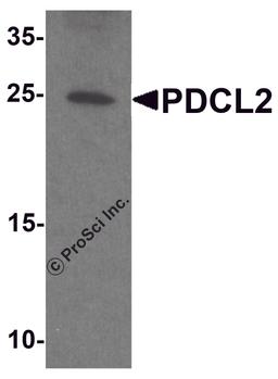 Western blot analysis of PDCL2 in rat liver tissue lysate with PDCL2 antibody at 1 μg/ml.