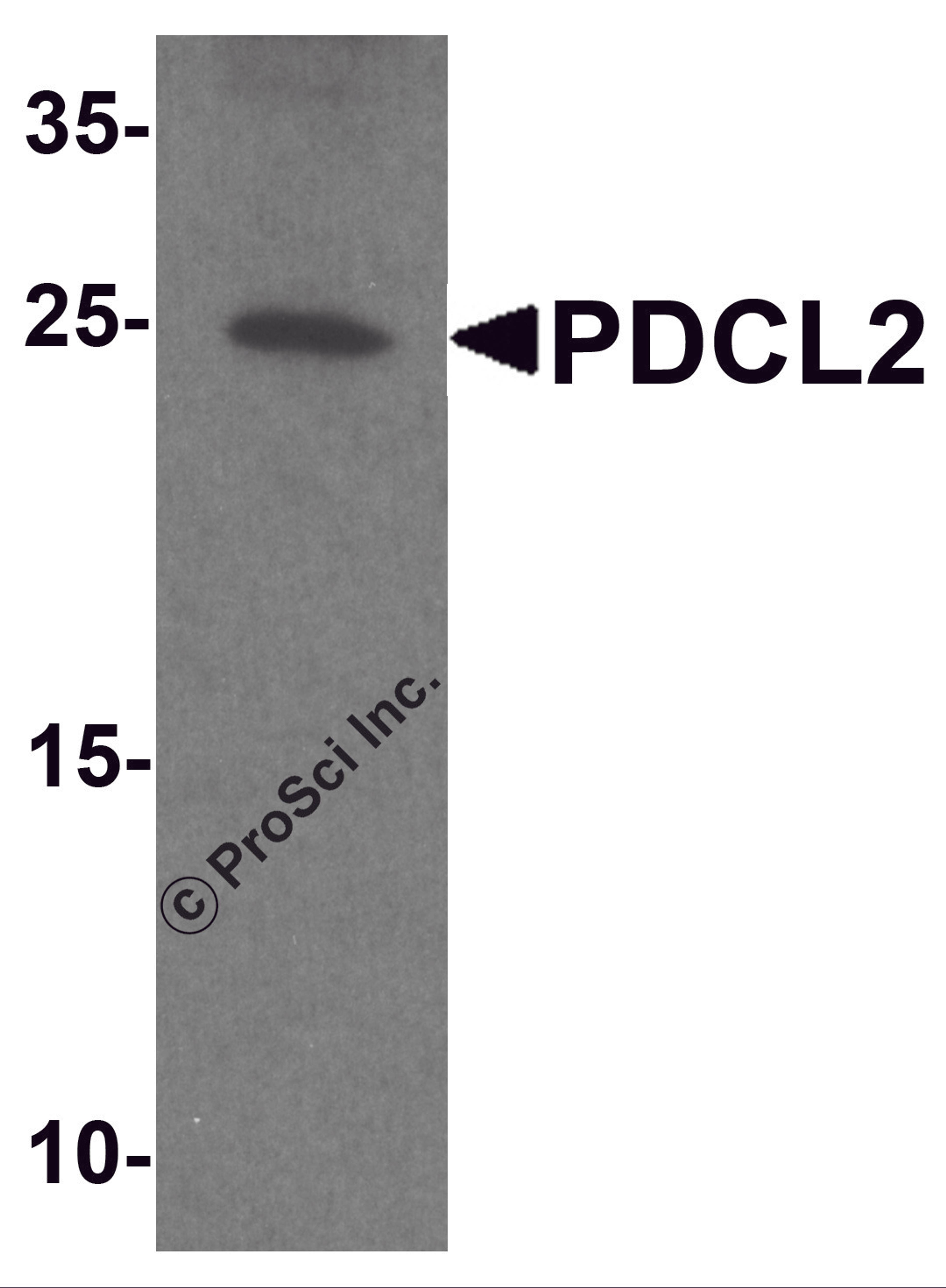 Western blot analysis of PDCL2 in rat liver tissue lysate with PDCL2 antibody at 1 μg/ml.