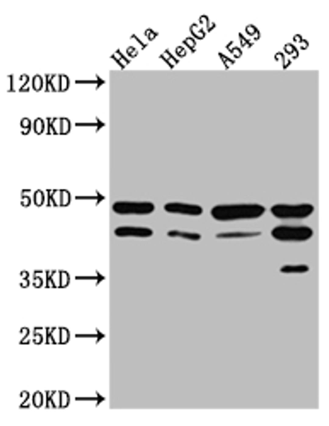 Western Blot. Positive WB detected in: Hela whole cell lysate, HepG2 whole cell lysate, A549 whole cell lysate, 293 whole cell lysate. All lanes: GSK3 beta Antibody at 1:1000. Secondary. Goat polyclonal to rabbit IgG at 1/50000 dilution. Predicted band size: 47, 49 kDa. Observed band size: 47 kDa. 
