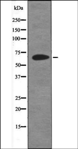 Western blot analysis of UV treated 293 whole cell lysates using ITK -Phospho-Tyr512- antibody