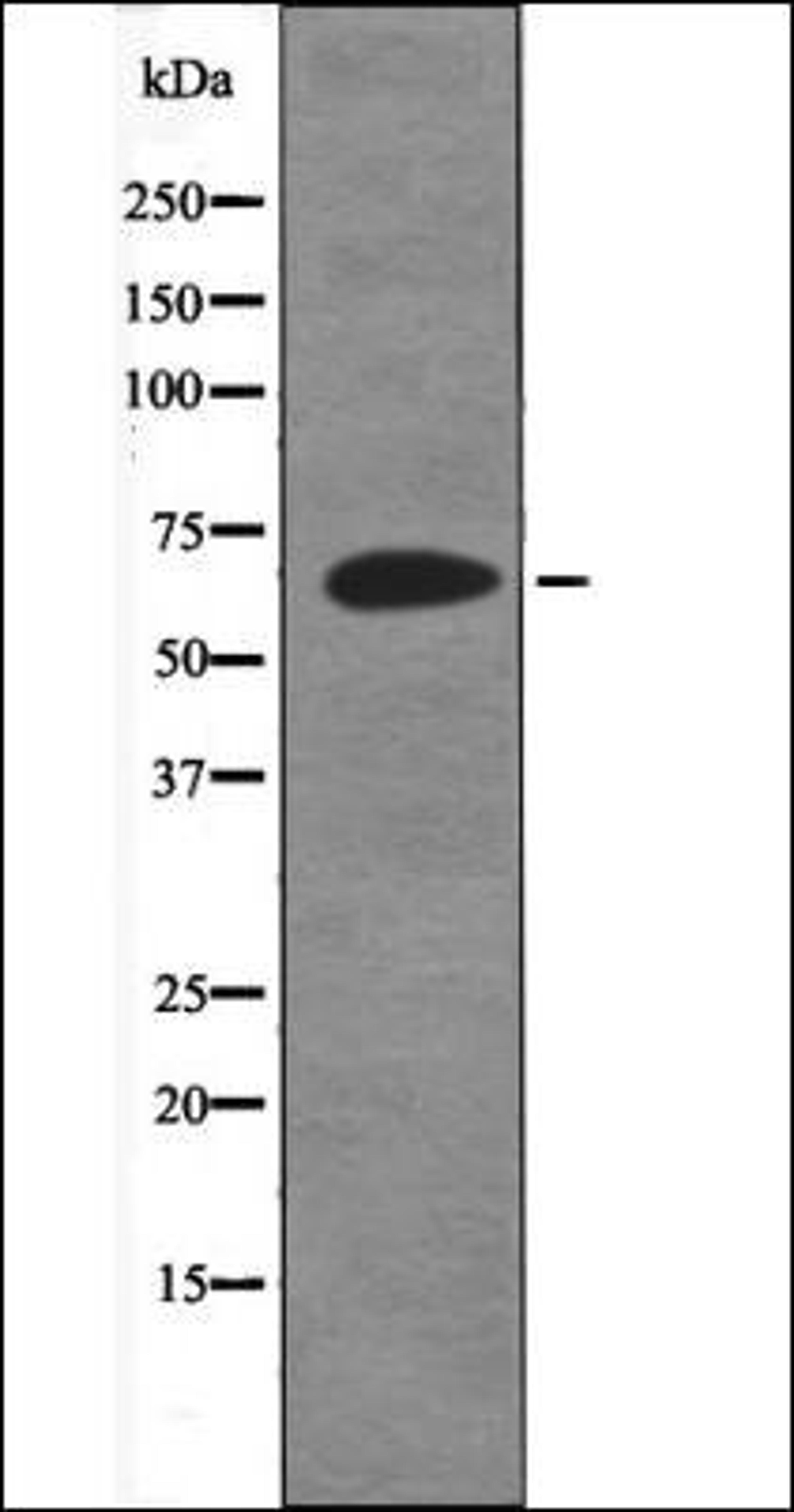 Western blot analysis of UV treated 293 whole cell lysates using ITK -Phospho-Tyr512- antibody