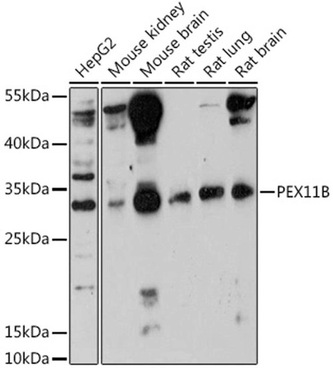 Western blot - PEX11B antibody (A18321)