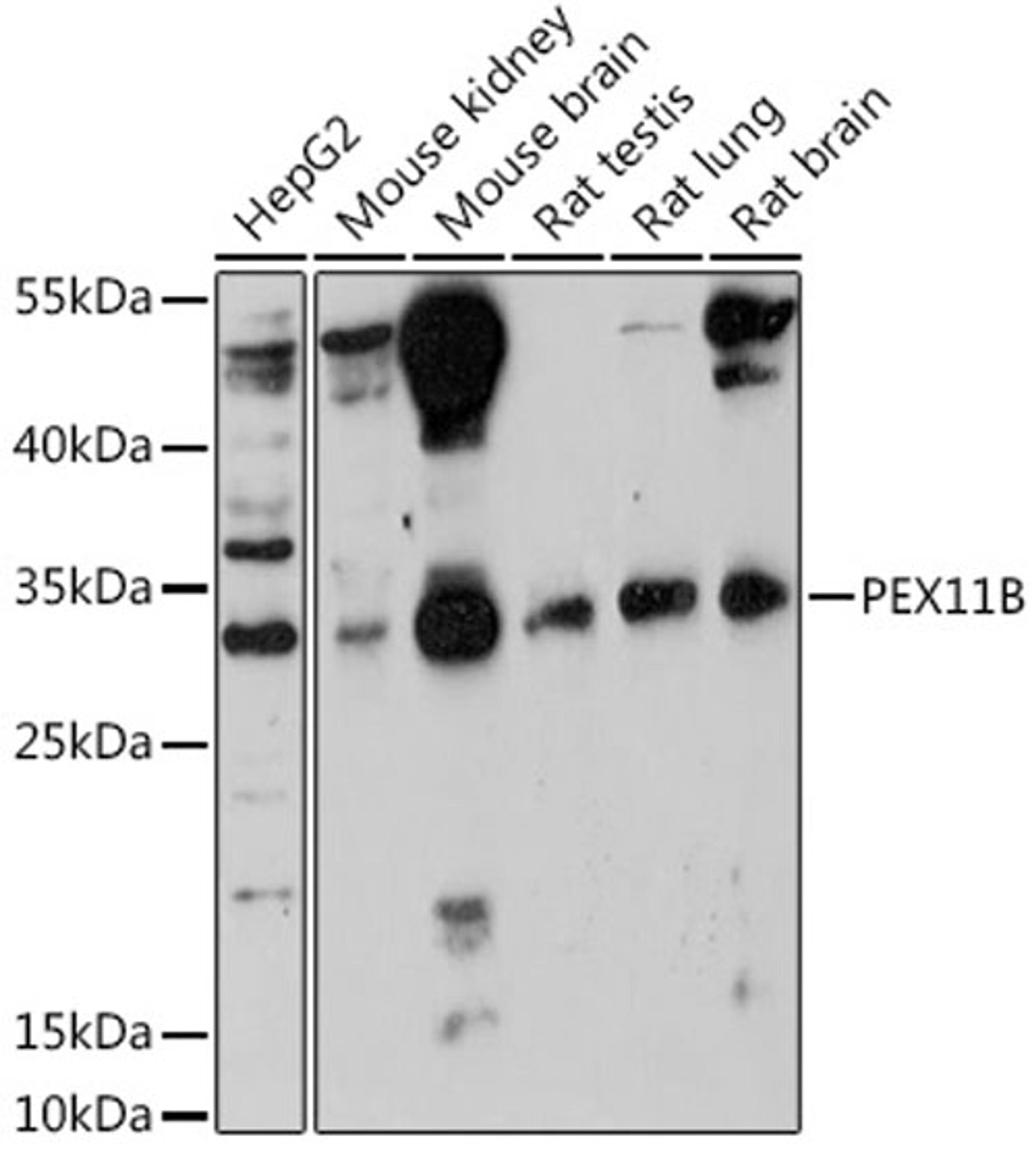 Western blot - PEX11B antibody (A18321)