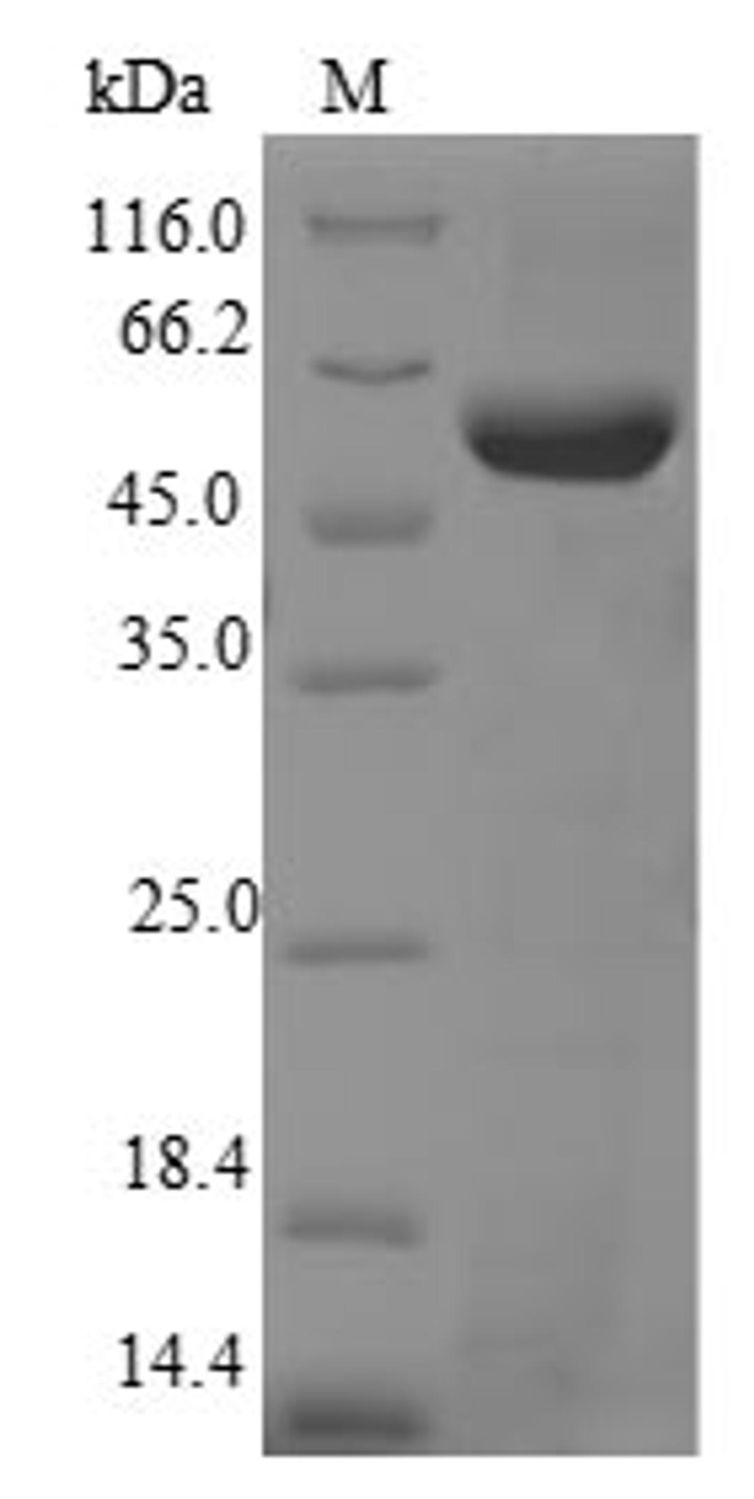 (Tris-Glycine gel) Discontinuous SDS-PAGE (reduced) with 5% enrichment gel and 15% separation gel.
