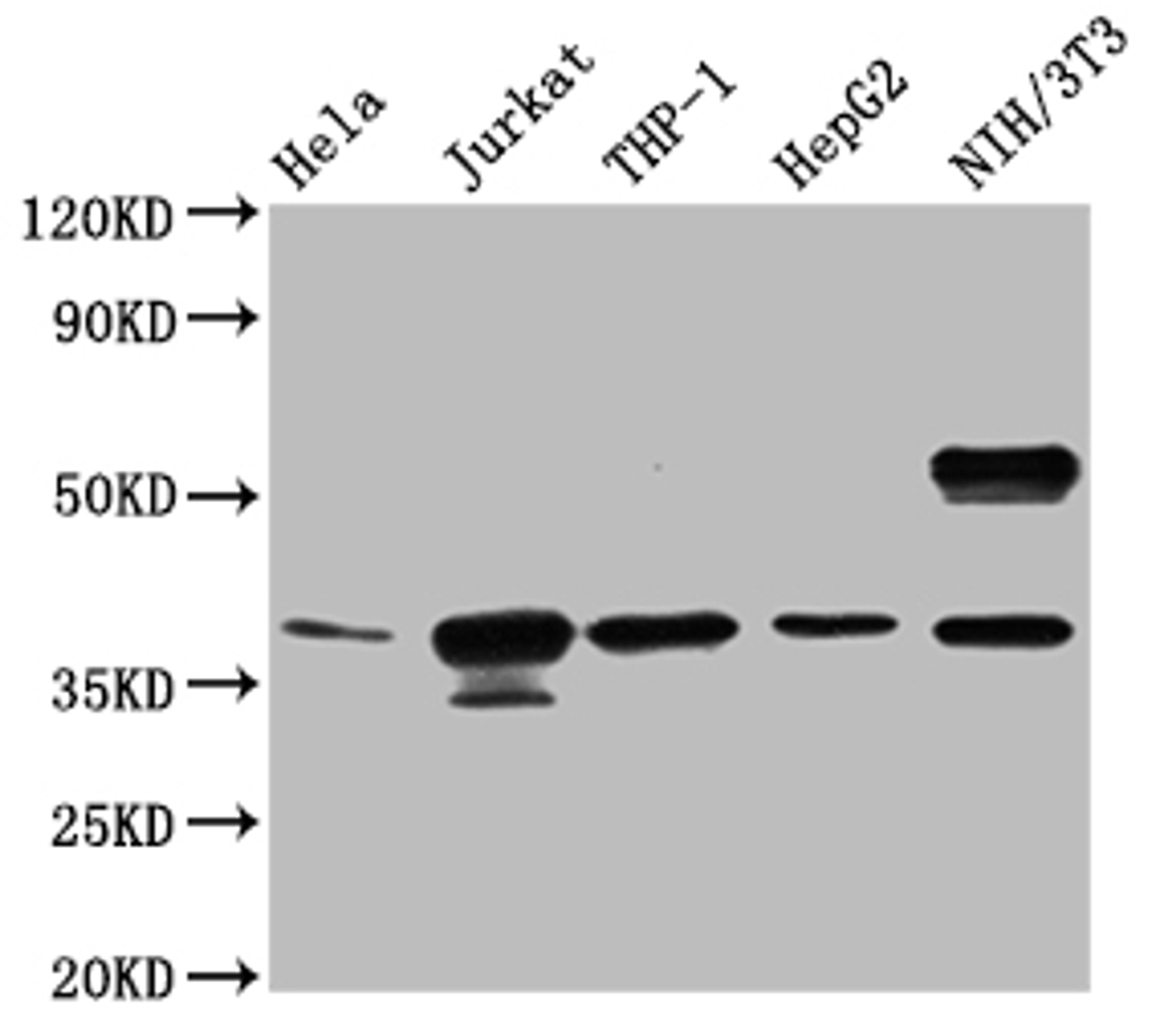 Western Blot. Positive WB detected in: Hela whole cell lysate, Jurkat whole cell lysate, THP-1 whole cell lysate, HepG2 whole cell lysate, NIH/3T3 whole cell lysate. All lanes: CLYBL antibody at 1:1000. Secondary. Goat polyclonal to rabbit IgG at 1/50000 dilution. Predicted band size: 38, 34 KDa. Observed band size: 38 KDa. Exposure time：5min