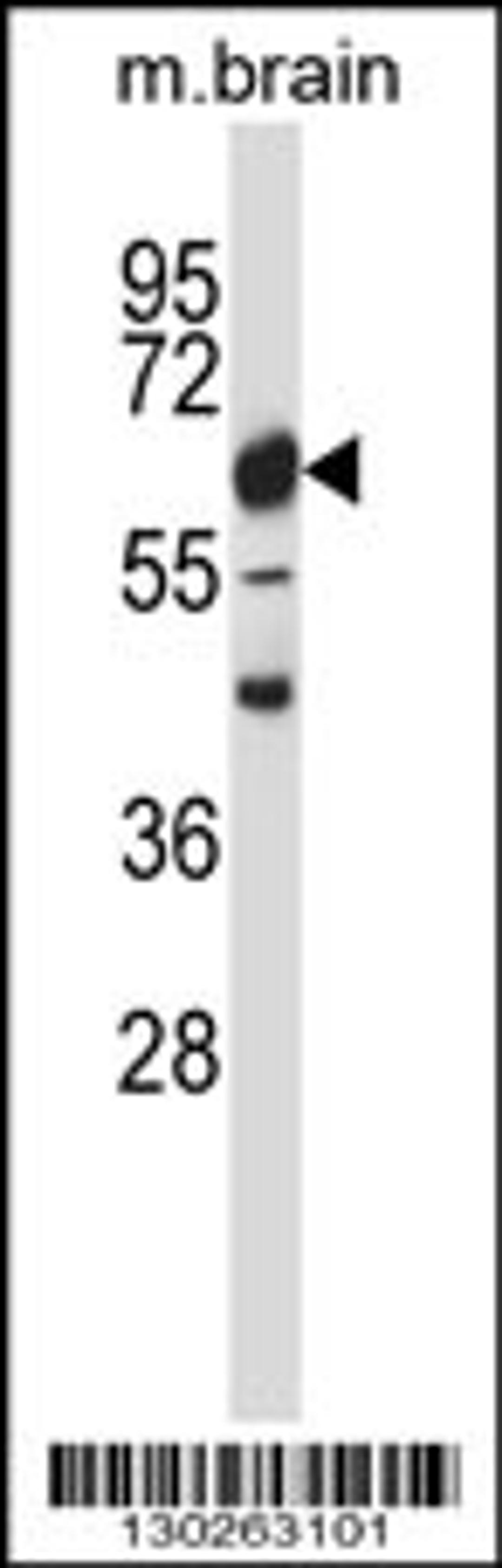 Western blot analysis in mouse brain tissue lysates (35ug/lane).