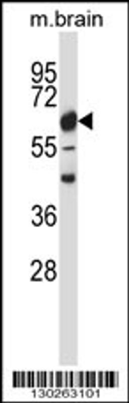 Western blot analysis in mouse brain tissue lysates (35ug/lane).