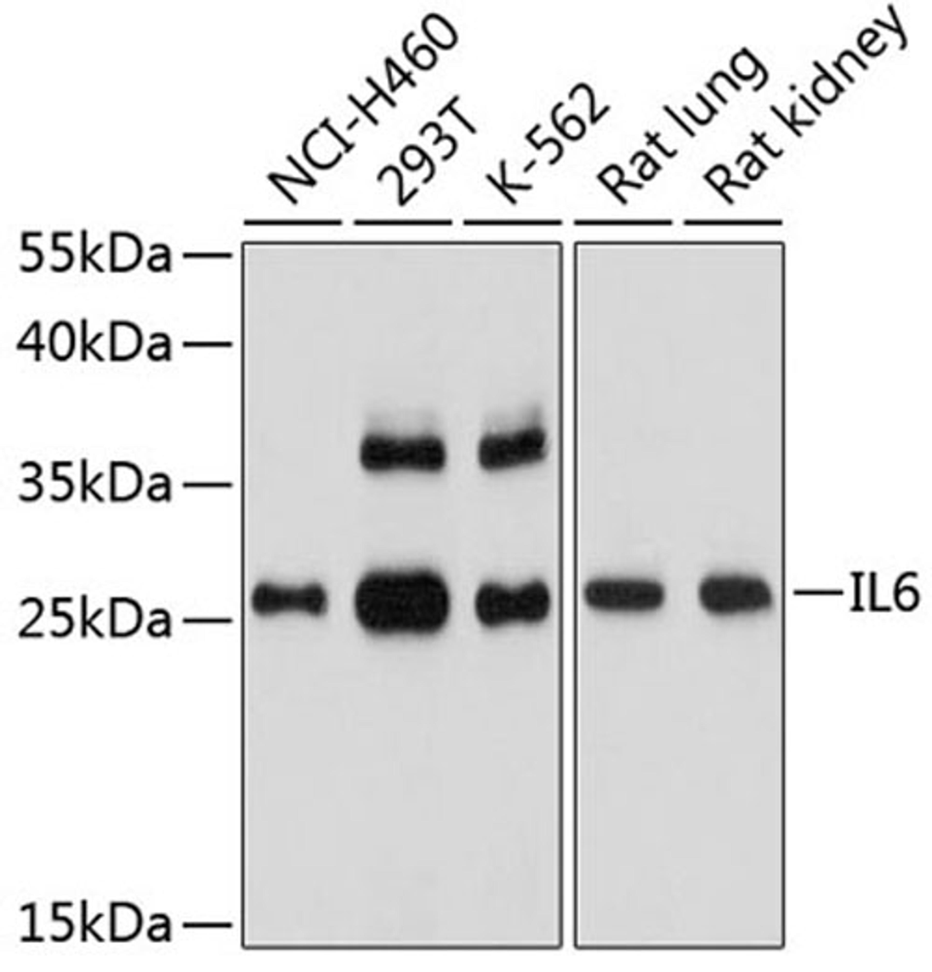 Western blot - IL6 antibody (A2447)