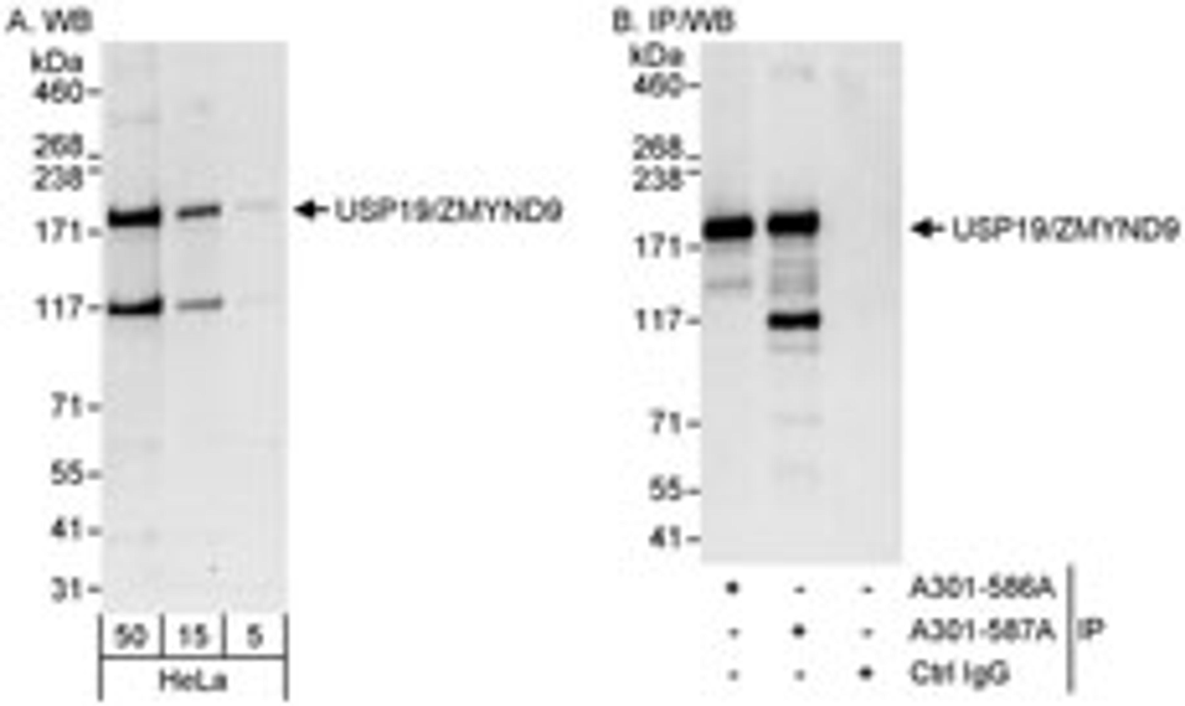 Detection of human USP19/ZMYND9 by western blot and immunoprecipitation.