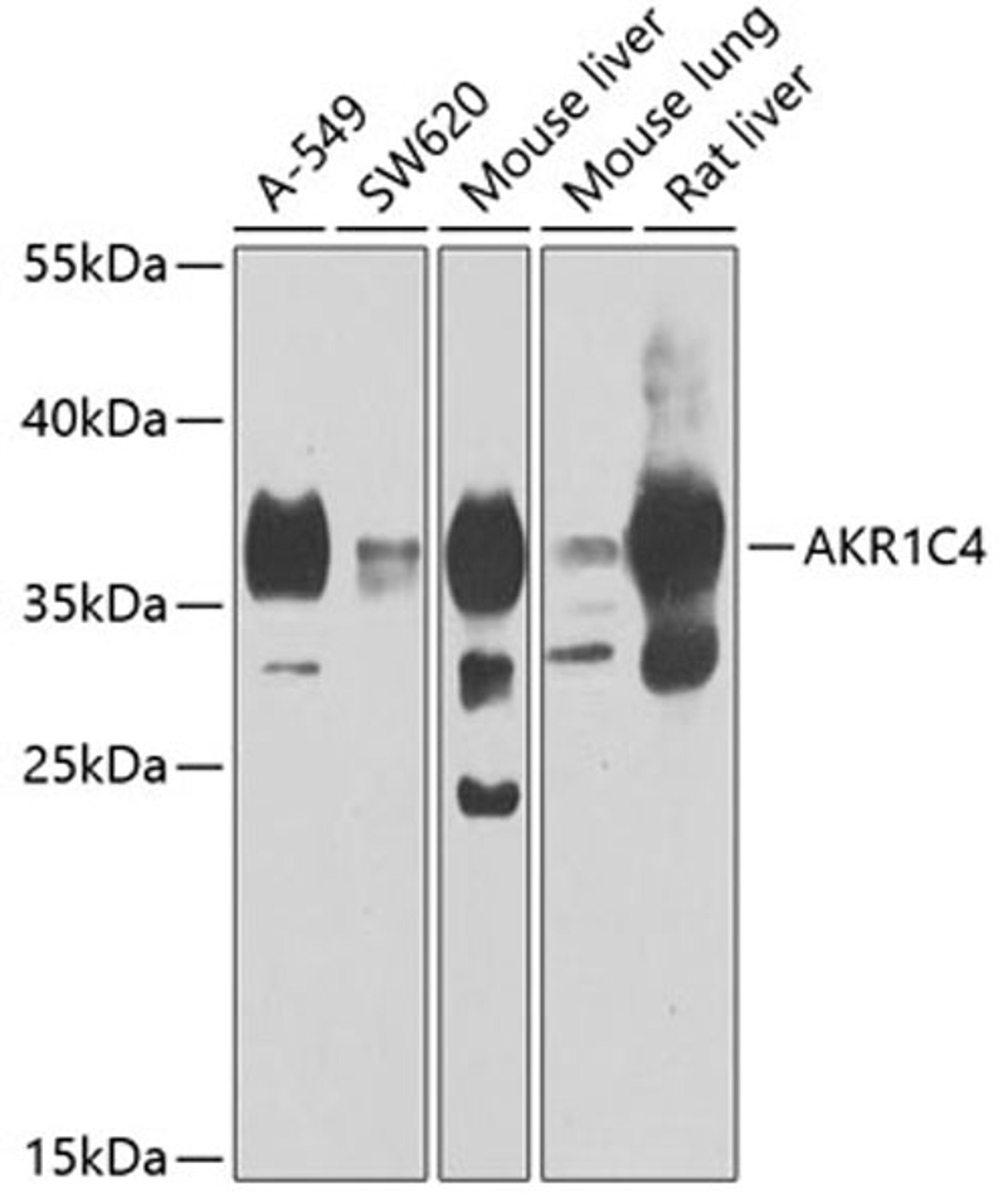 Western blot - AKR1C4 antibody (A7430)