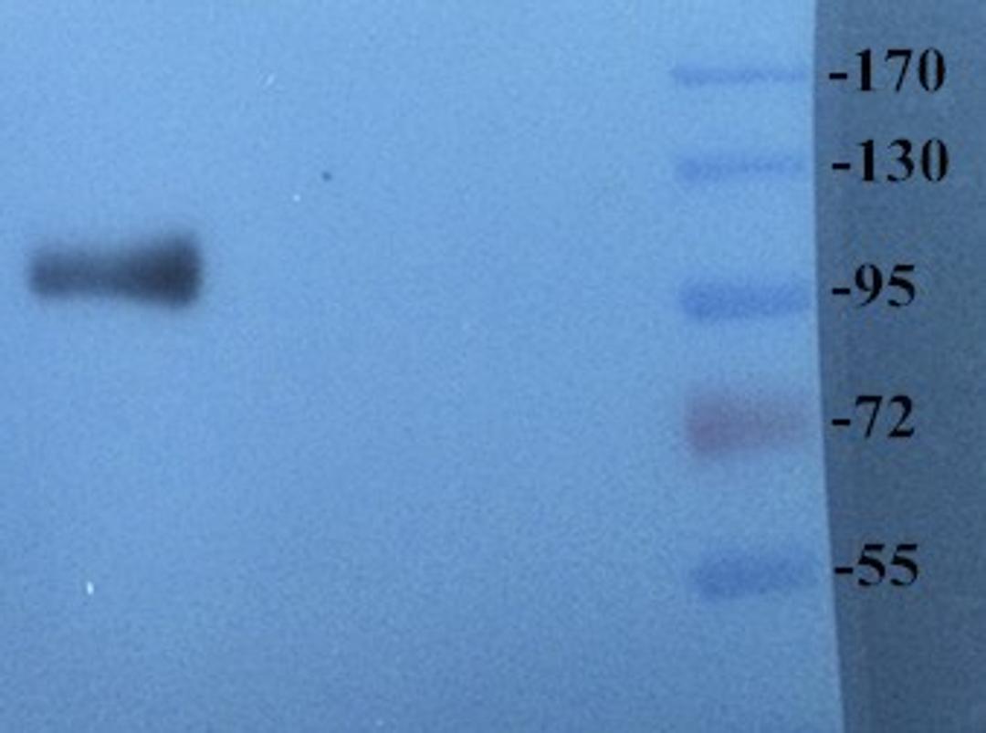 Western blot analysis of rat brain tissue using CD41 antibody (dilution of primary antibody at: 1:500)