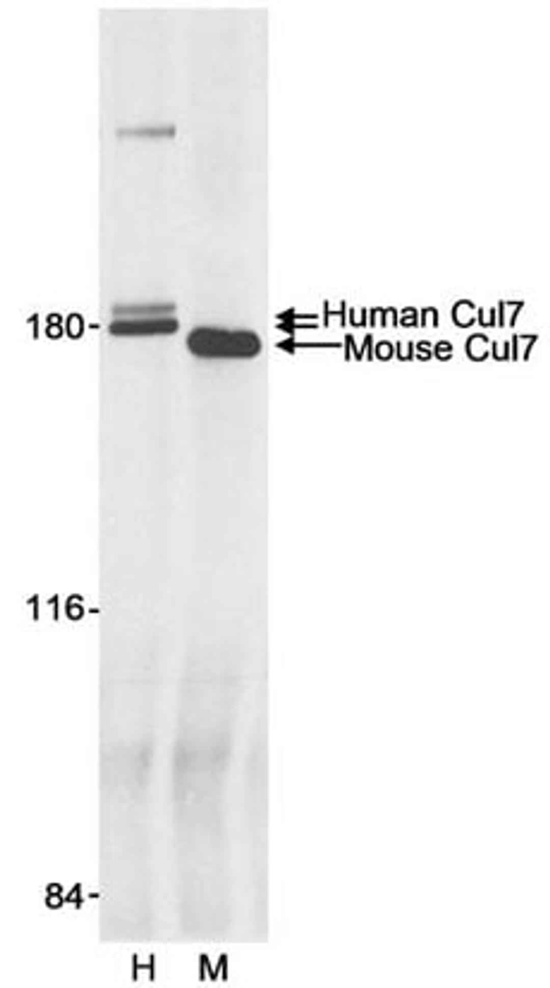 Detection of human and mouse Cul7 by immunoprecipitation.