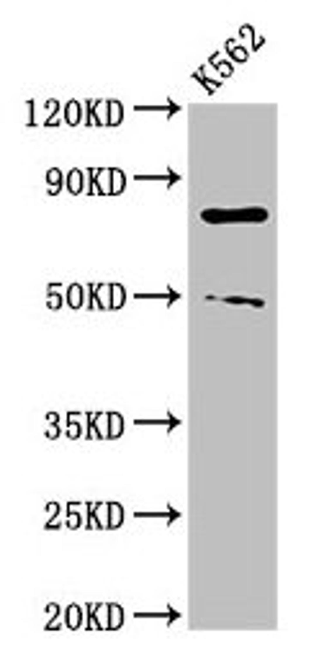 Western Blot. Positive WB detected in: K562 whole cell lysate. All lanes: PADI2 antibody at 3µg/ml. Secondary. Goat polyclonal to rabbit IgG at 1/50000 dilution. Predicted band size: 76, 50 kDa. Observed band size: 76, 50 kDa