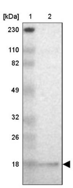 Western Blot: GMF beta Antibody [NBP1-89755] - Lane 1: Marker [kDa] 230, 110, 82, 49, 32, 26, 18<br/>Lane 2: Human cell line RT-4