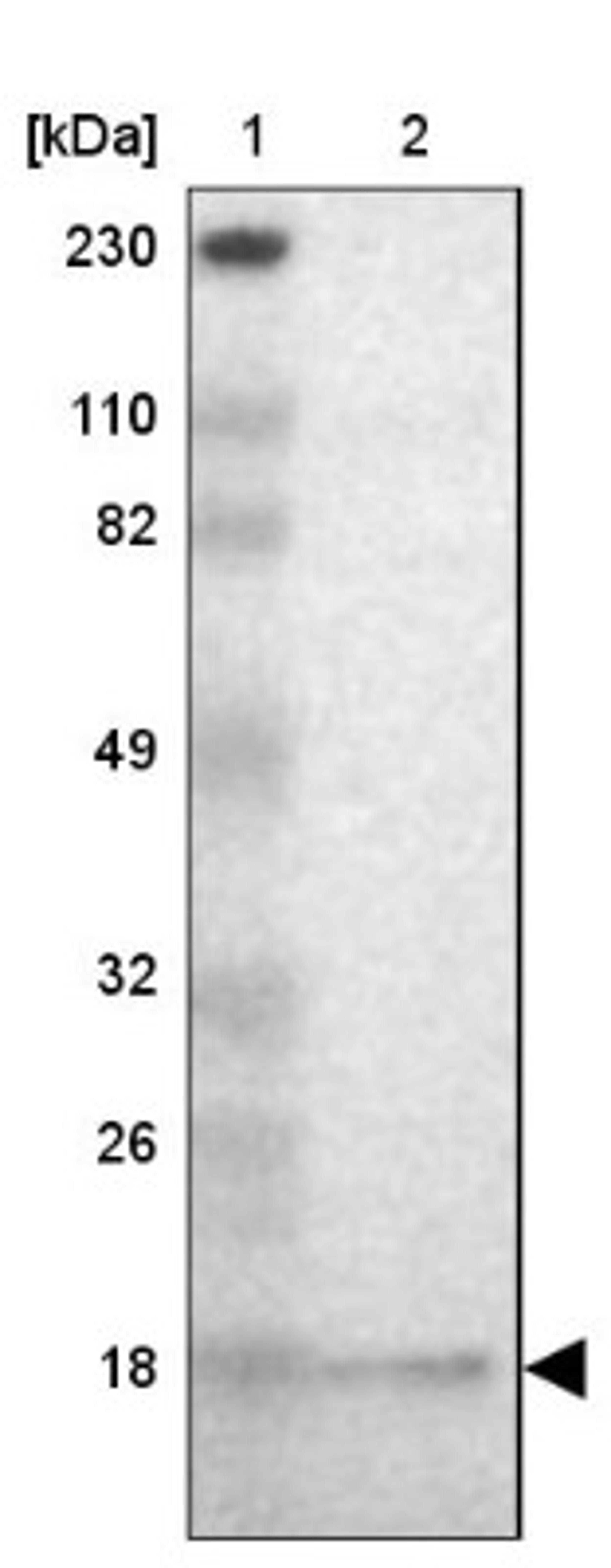 Western Blot: GMF beta Antibody [NBP1-89755] - Lane 1: Marker [kDa] 230, 110, 82, 49, 32, 26, 18<br/>Lane 2: Human cell line RT-4