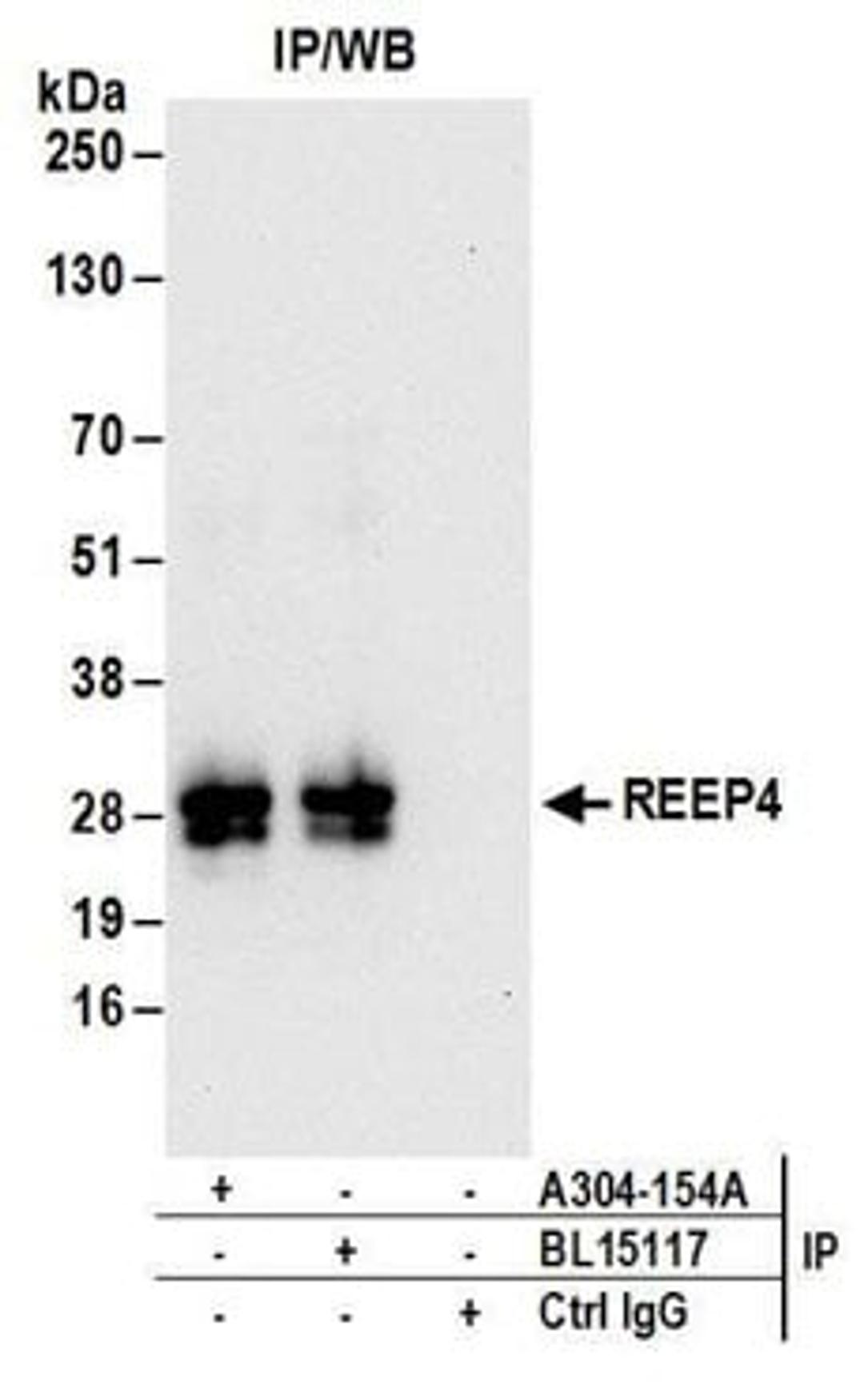 Detection of human REEP4 by western blot of immunoprecipitates.