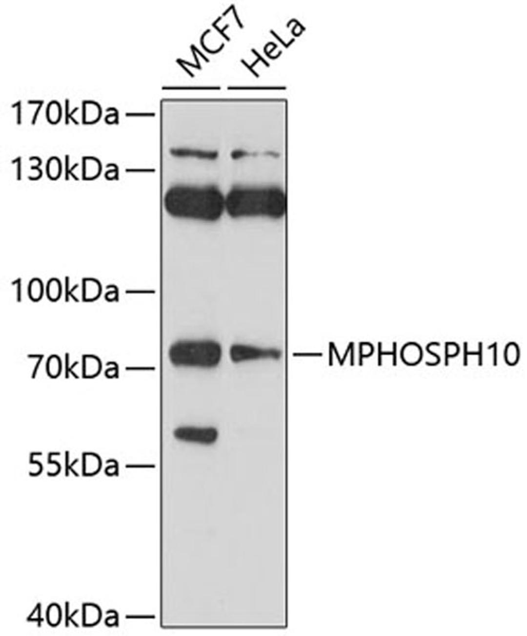 Western blot - MPHOSPH10 antibody (A10041)