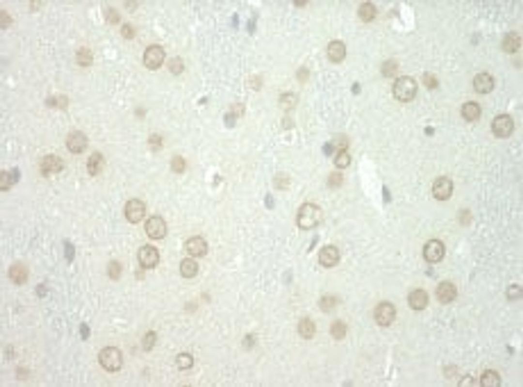 Detection of human WDFY3 by immunohistochemistry.