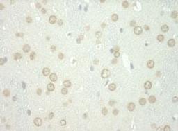 Detection of human WDFY3 by immunohistochemistry.