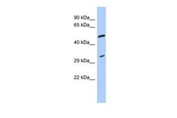 Antibody used in WB on Human THP-1 at 0.2-1 ug/ml.