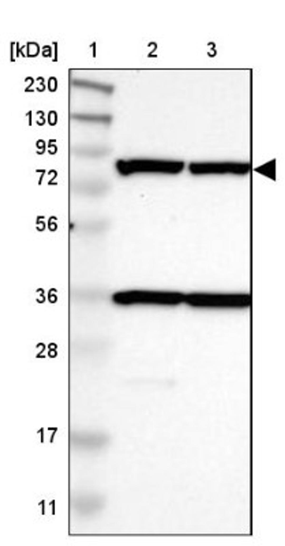 Western Blot: SEC23B Antibody [NBP1-85732] - Lane 1: Marker [kDa] 230, 130, 95, 72, 56, 36, 28, 17, 11<br/>Lane 2: Human cell line RT-4<br/>Lane 3: Human cell line U-251MG sp