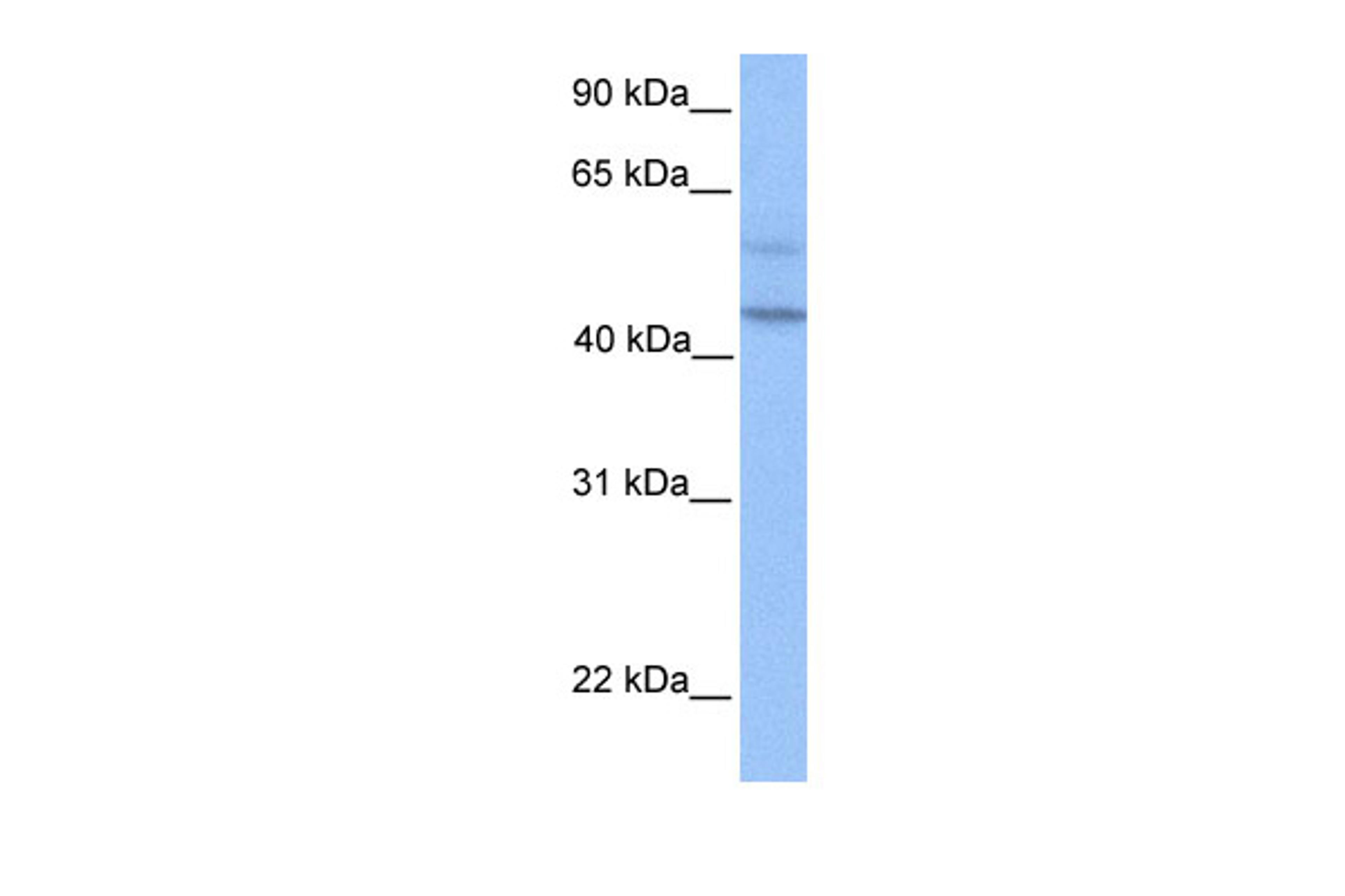 Antibody used in WB on Human HeLa at 0.2-1 ug/ml.