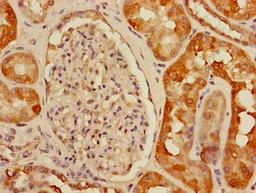 Immunohistochemistry of paraffin-embedded human kidney tissue using CSB-PA839815LA01HU at dilution of 1:100