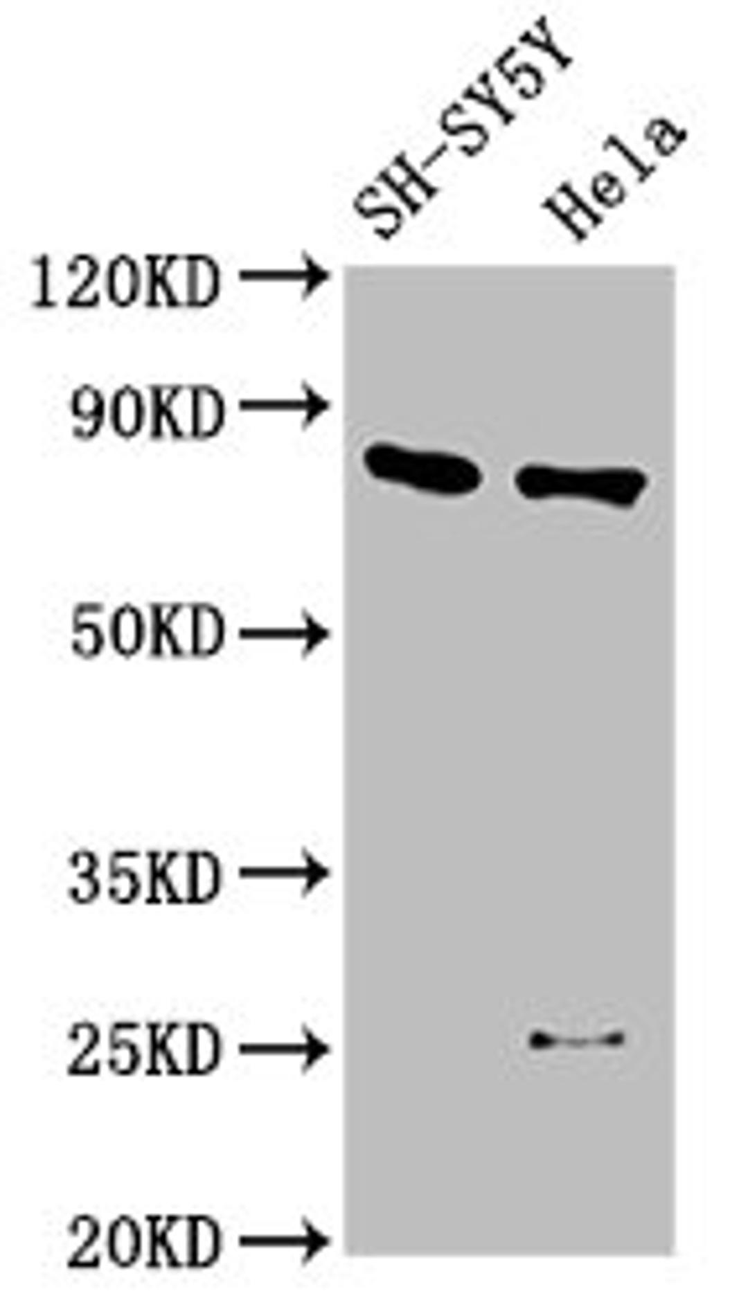 Western Blot. Positive WB detected in: SH-SY5Y whole cell lysate, Hela whole cell lysate. All lanes: CTNNB1 antibody at 2.5µg/ml. Secondary. Goat polyclonal to rabbit IgG at 1/50000 dilution. Predicted band size: 86 kDa. Observed band size: 86 kDa