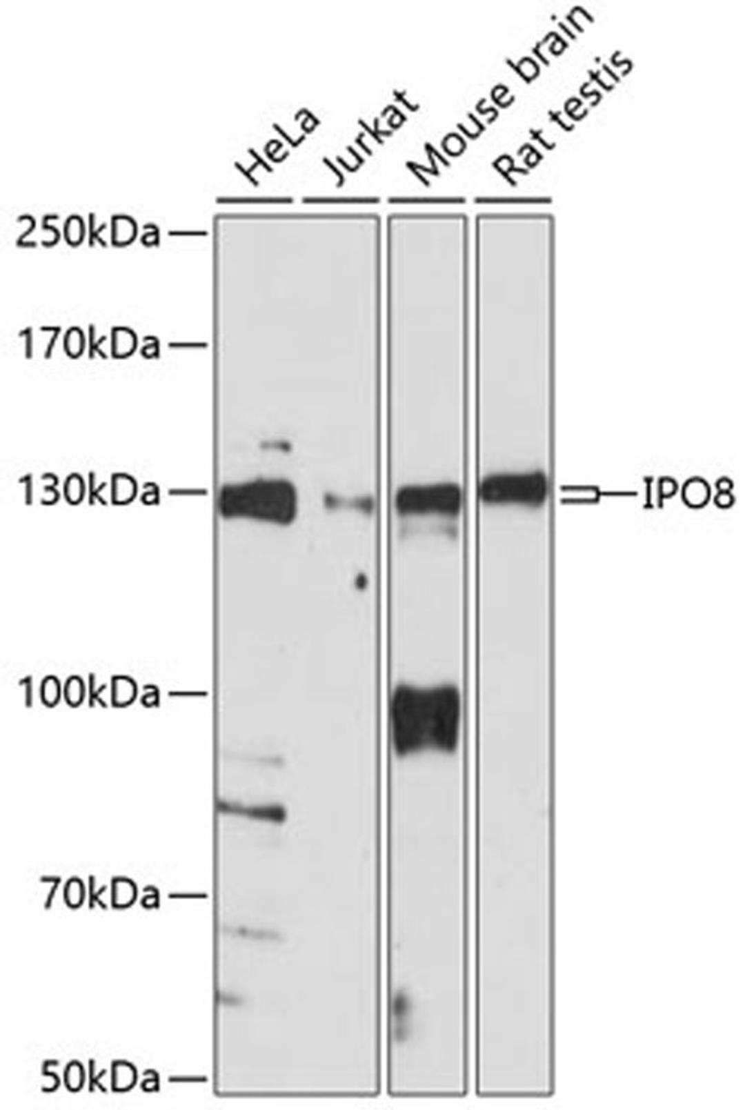 Western blot - IPO8 antibody (A14679)