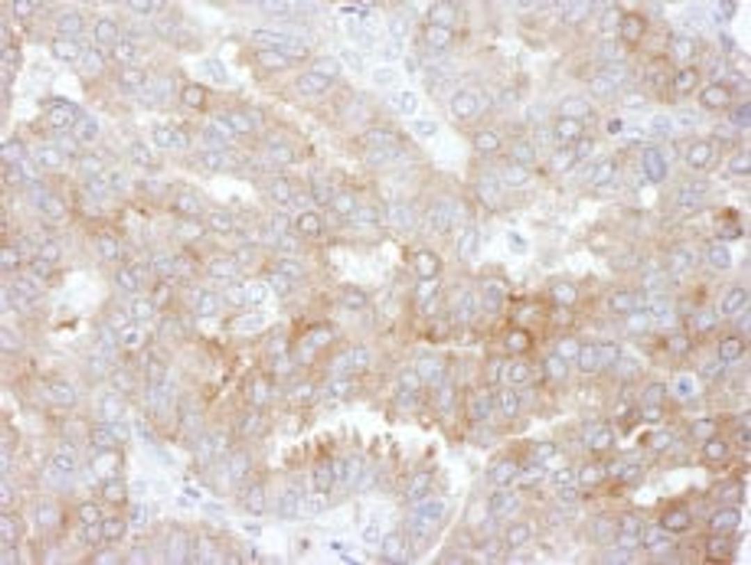 Detection of human NHERF1 by immunohistochemistry.