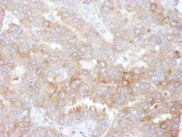 Detection of human NHERF1 by immunohistochemistry.