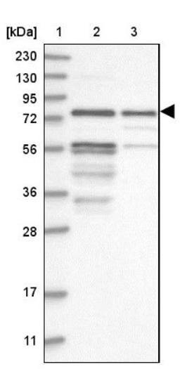 Western Blot: Kazrin Antibody [NBP1-92038] - Lane 1: Marker [kDa] 230, 130, 95, 72, 56, 36, 28, 17, 11<br/>Lane 2: Human cell line RT-4<br/>Lane 3: Human cell line U-251MG sp