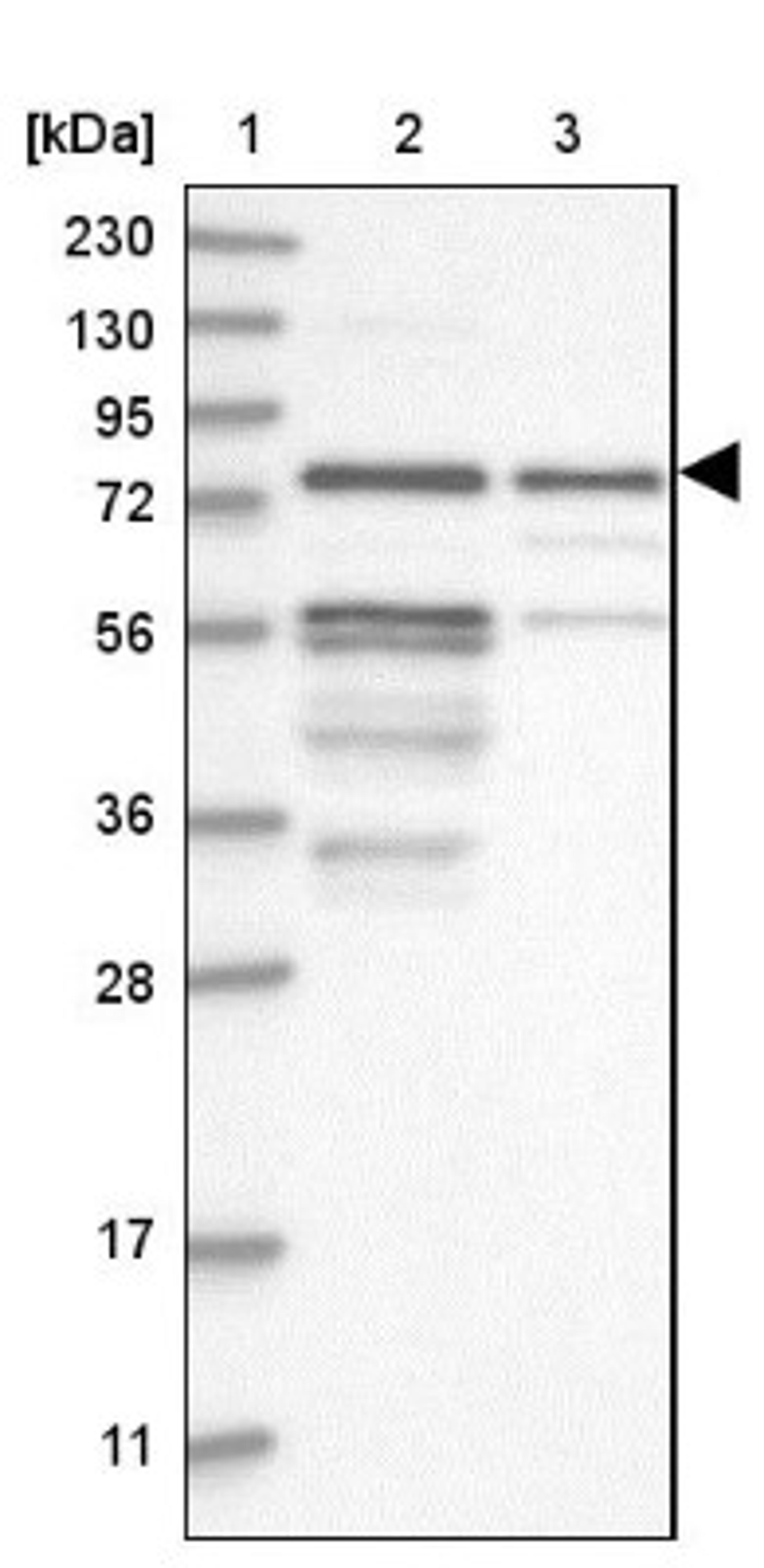 Western Blot: Kazrin Antibody [NBP1-92038] - Lane 1: Marker [kDa] 230, 130, 95, 72, 56, 36, 28, 17, 11<br/>Lane 2: Human cell line RT-4<br/>Lane 3: Human cell line U-251MG sp