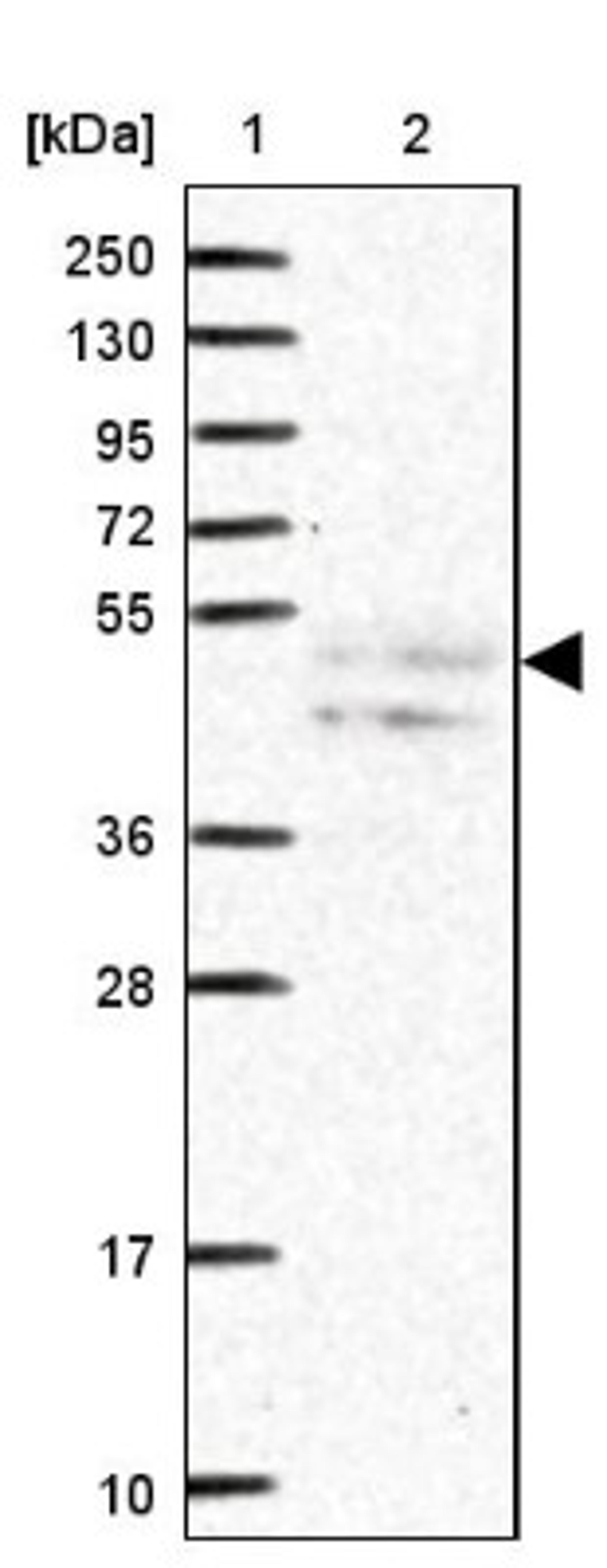 Western Blot: CRLF1 Antibody [NBP1-85605] - Lane 1: Marker [kDa] 250, 130, 95, 72, 55, 36, 28, 17, 10<br/>Lane 2: Human cell line RT-4