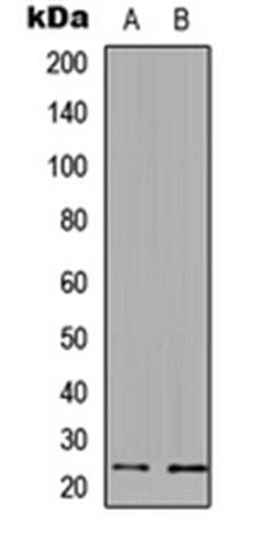 Western blot analysis of A549 (Lane 1), PC12 (Lane 2) whole cell lysates using UBE2E3 antibody