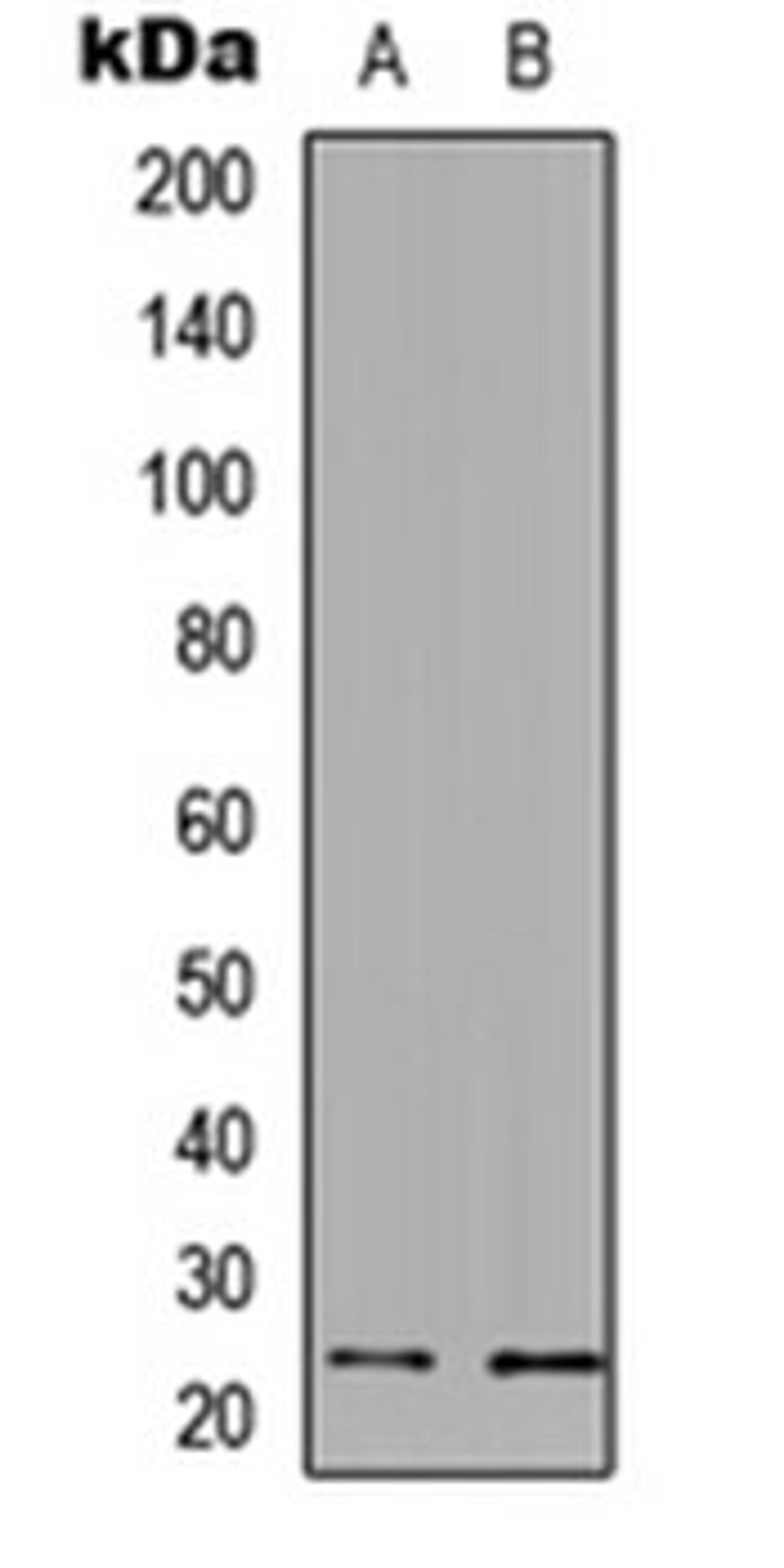 Western blot analysis of A549 (Lane 1), PC12 (Lane 2) whole cell lysates using UBE2E3 antibody