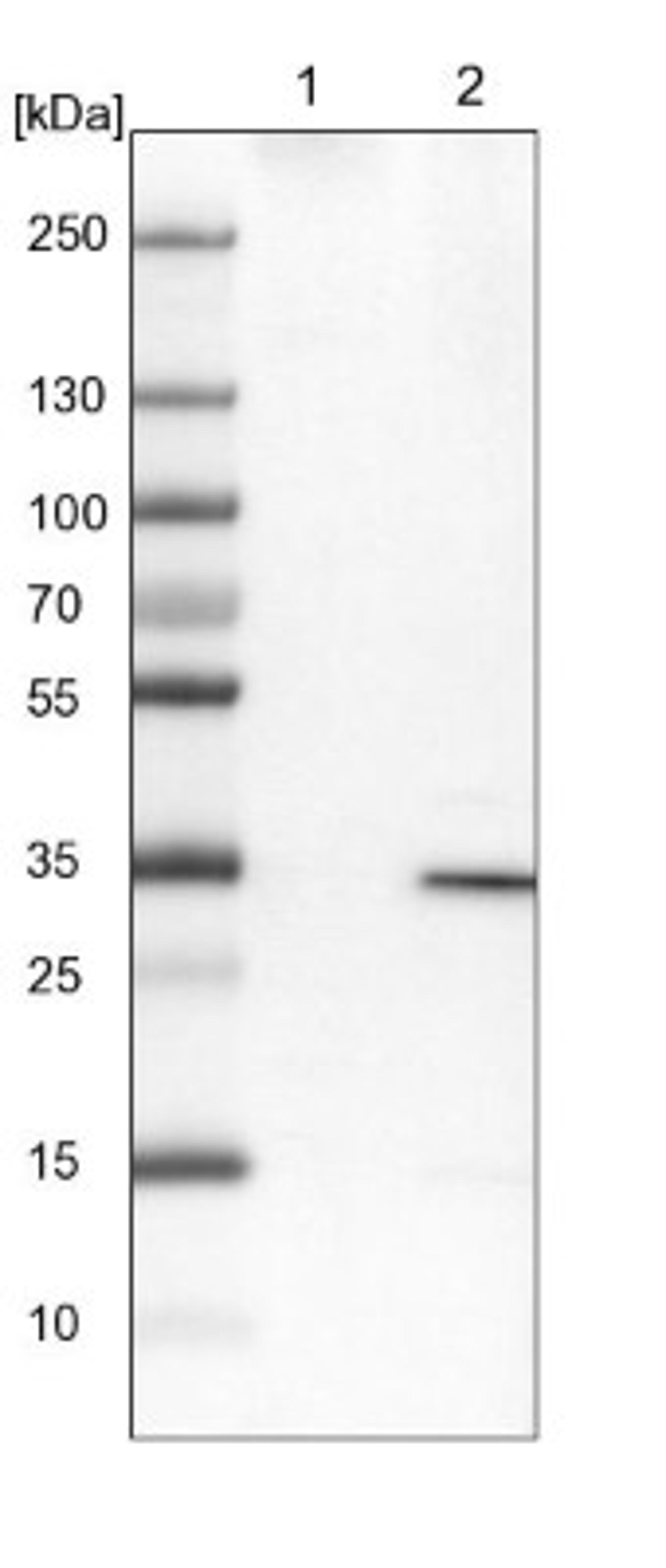 Western Blot: UBAC2 Antibody [NBP1-93893] - Lane 1: NIH-3T3 cell lysate (Mouse embryonic fibroblast cells)<br/>Lane 2: NBT-II cell lysate (Rat Wistar bladder tumour cells)