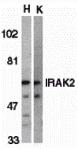 Western blot analysis of IRAK2 in HeLa (H) and K562 (K) whole cell lysate with IRAK2 antibody (C2) at 2 &#956;g/mL.