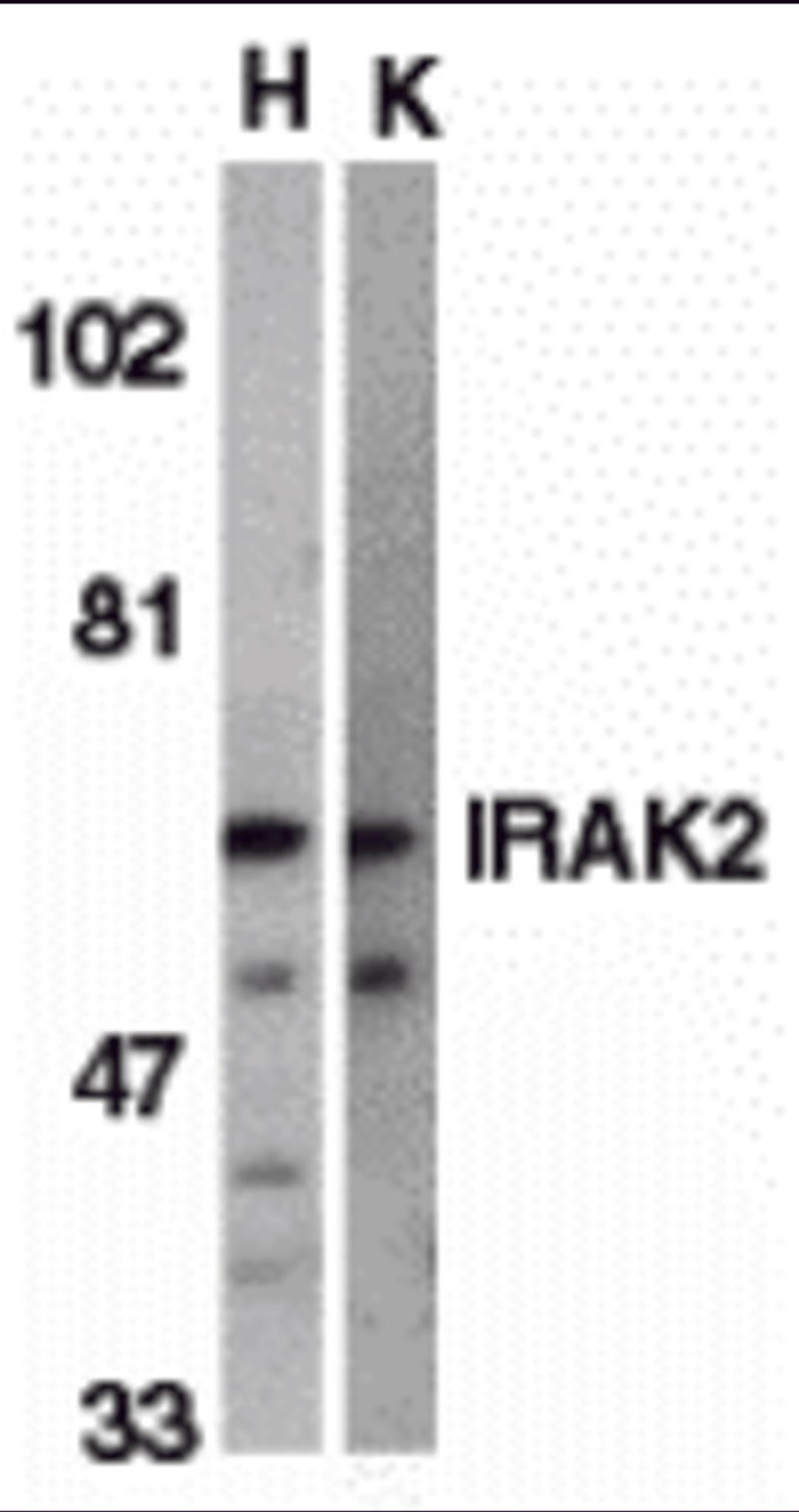 Western blot analysis of IRAK2 in HeLa (H) and K562 (K) whole cell lysate with IRAK2 antibody (C2) at 2 μg/mL.