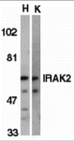 Western blot analysis of IRAK2 in HeLa (H) and K562 (K) whole cell lysate with IRAK2 antibody (C2) at 2 μg/mL.